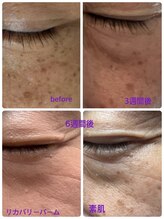 ヨウキ(YOKI)/シミケアにも効果抜群◎