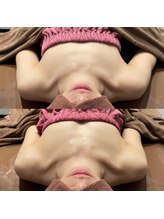 ロココ 豊田店(Rococo)/ビフォーアフター