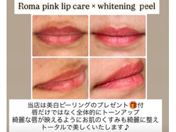 ボーテドリッシュ(Beaute de Riche)/ローマピンク【リップ】B→ A