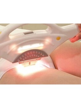 デリケート部分の脱毛/Vライン/VIO