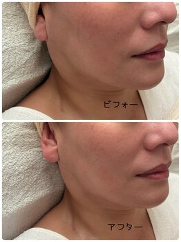 ナナプラス(nana plus)/乾燥ケア