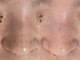 アルカンシエル(arcenciel)の写真/黒ずみ・角栓も、気になる毛穴の開きも。ざらつきや凹凸をケアして、つるんとなめらかな素肌へ。