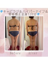 ビューティースタジオ エイワン(A1)/【痩身】Before ＆ After