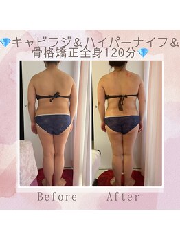 ビューティースタジオ エイワン(A1)/【痩身】Before & After