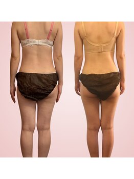 シエスタ(SIESTA)/Before→After 　1年間の変化