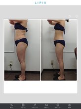 健康痩身研究所 名和店/ビフォーアフター