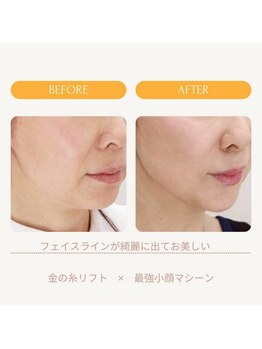 ムーンライズ(moonrise)/