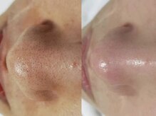 エムズビューティスタジオ エステ リラク 西川口店(M's Beauty Studio)