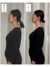 エクラ(eclat)/120分コース4回施術