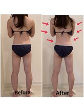 スペチアーレ 夙川/顔もボディもお悩み解決