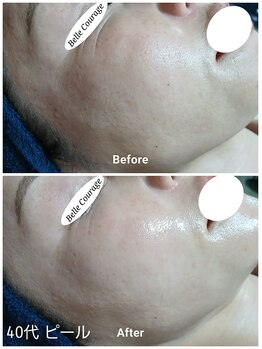 ベルクラージュ(Belle Courage)/40代　くすみ・乾燥