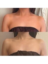 salon SUI 祐天寺【スウェディッシュマッサージ/美容整体/首肩こり頭痛】/美容整体