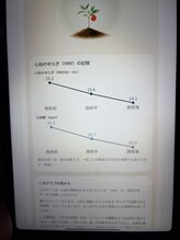 森の日々/RMSSD計測～睡眠の質を可視化～