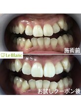 ルブラン 奈良店(Le Blanc)/年齢関係なく歯は綺麗に。。。