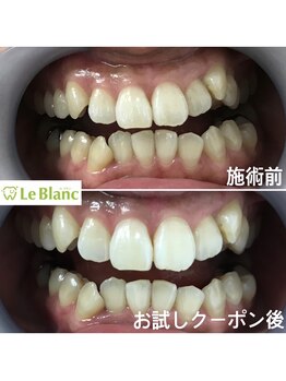 ルブラン 奈良店(Le Blanc)/年齢関係なく歯は綺麗に。。。