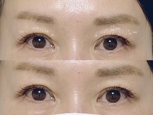 月 自由が丘(tsuki)/《マツエク》左右差あり