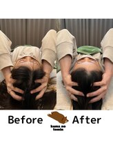 クマの冬眠 高知店/お顔と身体のトータルケア