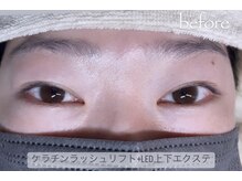 イクアイラッシュ(iku eyelash)/Before/LED上下+まつげパーマ