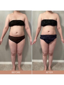 リファラ 光の森店(REFALA)/【痩身/30代女性】約3ヶ月の結果