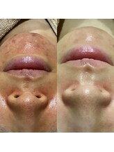 エヌエー(na)/敏感肌でもう悩まない。