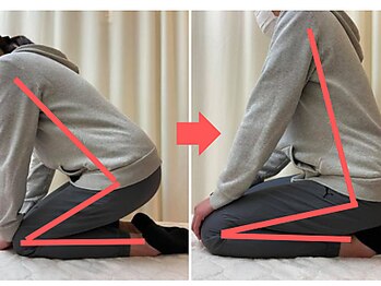 杉本接骨鍼灸院/膝の症状例：施術を受けた方の声