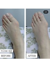 レディア 伊勢店(Re:Dear)/足の歪みにアプローチ