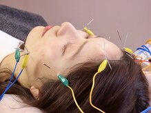 爽健美の雰囲気(美容鍼をすると!血色・ハリ・リフトUP♪詳しくはブログへ)