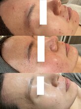 スイ メゾン アトリエ(SUE Maison Atelier)/レストセルトリートメント