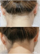 エムズスタイル ネイルバー(M's Style NAIL BAR)/うなじ脱毛