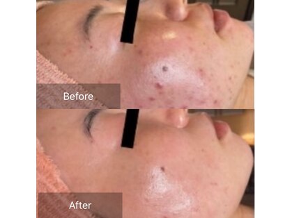 トータルエステサロン ポイント(POINT)の写真