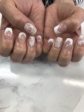 ベベ 伊丹店(BeBe)/レ-ス風ネイル