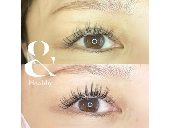 シュエット(Chouette)/アンドヘルシー140本