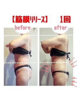 ビューティサロン キヨの部屋(beauty salon)/【筋膜リリース】　１回