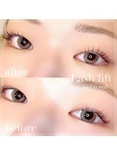 ラミシア(lamicia)/ビフォー、アフター