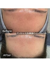 エルエーズ(Elleaise)/アンストレスで水光肌へ！