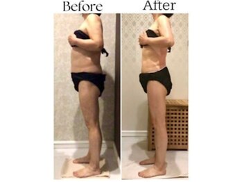 ラヴィニティ 自由が丘店(Lavinity)/【40代】ビフォー、アフター