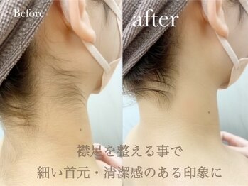 オーパーツ(OOPARTS)/シェービング/ブライダル/うなじ