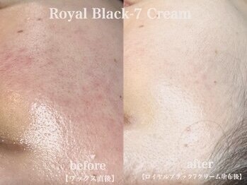 ハリウッドブロウリフト ワクシー 青山店(HOLLYWOOD BROW LIFT WAXYYY.)/WAX後の赤み、史上最速で鎮静!