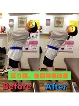 ヒデ整体院(Hide整体院)/猫背矯正骨盤矯正B/A肩こり腰痛