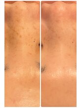 アールヨンマルハチ フェイスアンドアイ(R408.face&eye)/もう隠さなくても大丈夫