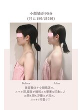 トゥインクル 麻布(twinkle)/南麻布/小顔矯正/勝山式美容矯正