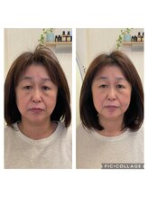 友愛はりきゅう美容整体院/ELコスメティック美容鍼