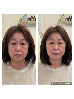 友愛はりきゅう美容整体院/ELコスメティック美容鍼
