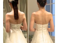 アールオーエス(ROS)の雰囲気（体感/見た目でもわかる結果◎前後で採寸し数字でも効果を実感）