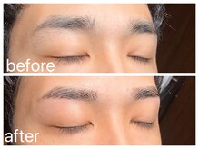 クラシックス(CLASSICS)/眉毛脱毛