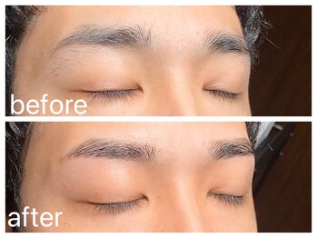 クラシックス(CLASSICS)/眉毛脱毛