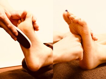 ビハインド 栄店(Behind)の写真/【夏本番】サンダルを綺麗に履きこなす！ヒールでボロボロのかかと、かたいタコ、辛い魚の目もおまかせ♪