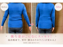 ヨサパーク アカーシャ(YOSA PARK AKASHA)/茂原の温活痩身サロン。