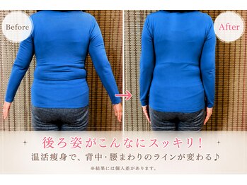 ヨサパーク アカーシャ(YOSA PARK AKASHA)/茂原の温活痩身サロン。