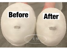 美極 トータルビューティー(美極 TOTAL BEAUTY)/恵比寿/小顔コルギ/エステ/